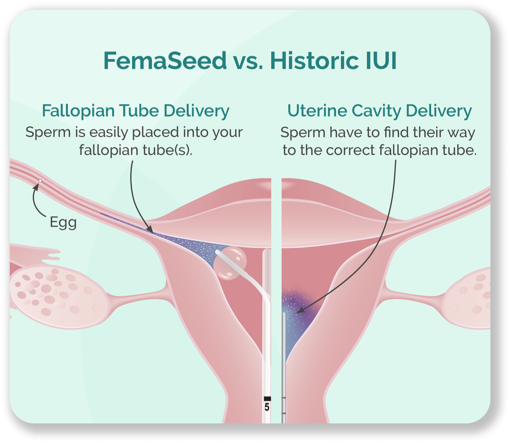 Femaseed vs. Historic IUI comparison graphic.