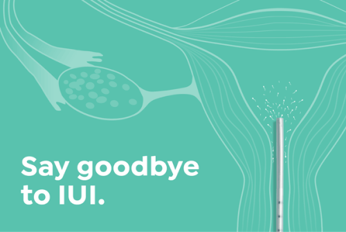 A line diagram of a uterus illustrating traditional IUI with text that says: Say goodbye to IUI